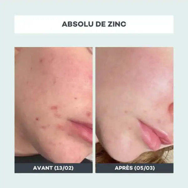Absolu de Zinc – Image 3