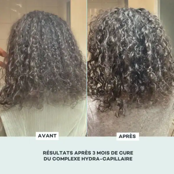 Hydra Capillaire – Image 4