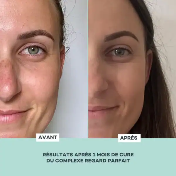 Complexe Regard Parfait – Image 5