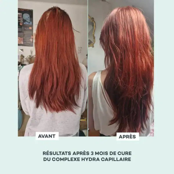 Hydra Capillaire – Image 5