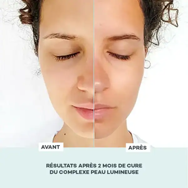 Complexe Peau Lumineuse – Image 3