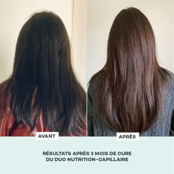 Nutrition-Capillaire – Image 6