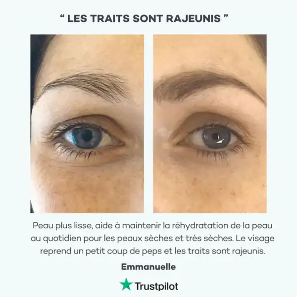 Absolu Hyaluronique – Image 5