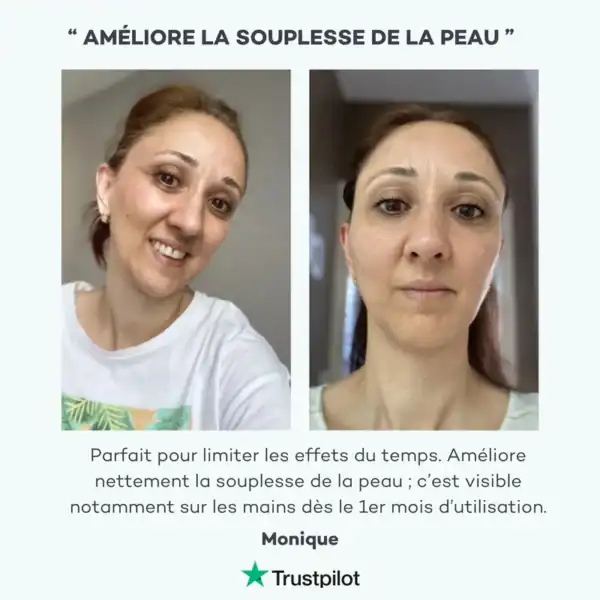 Absolu de Collagène – Image 10