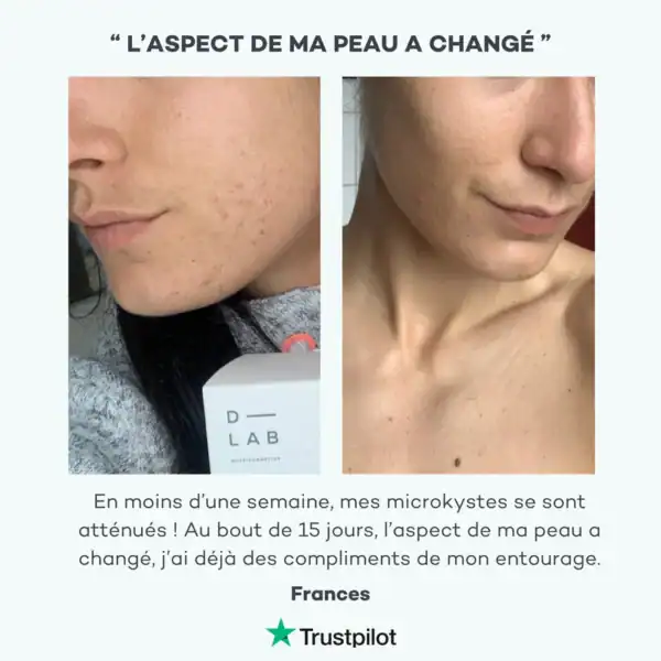 Programme Peau-Parfaite – Image 6